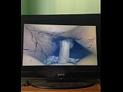 trimb33a0c5e-dcf6-4d7b-9879-8472635a3e31mov