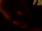 damaged Penis by Pump use of NEW 1s (1)
