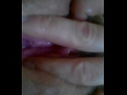 raw vulva