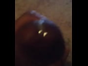 vocal stroke and fat sack