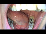 jaws annie movie 1 preview