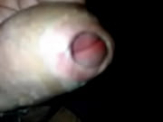 skin pulling3gp