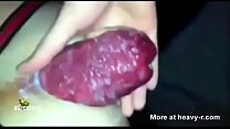 u043au043eu043du0447u0430u044f u043du0430 prolapse Thumbnail