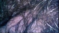 Exciting endoscope exploration of mom's hairy pussy and her asshole