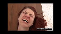 Anal 2 Thumbnail