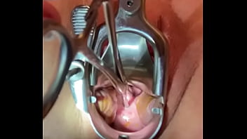 Sound tenaculum applying traction to cervix