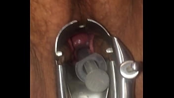 Artificial Insemination Putting Cum in Cervix