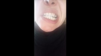 وجه جميل ، ولكن أسنان فاسدة!