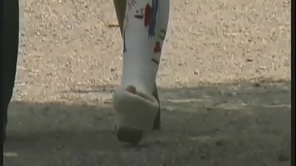 oberschenkelgips sex movie [ Duration: 05:40 ]